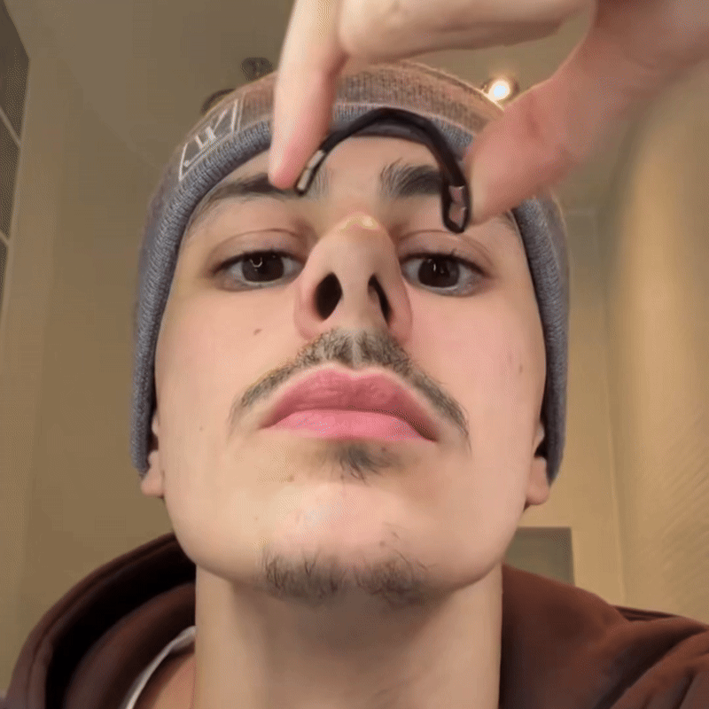 Kit Dilatador Nasal AirBoost Pro