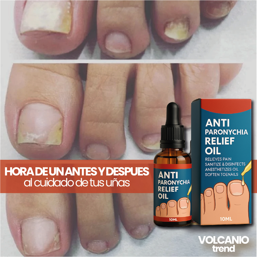 ToeNail Plus Tratamiento de Hongos.