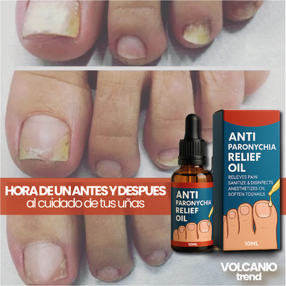 ToeNail Plus Tratamiento de Hongos.